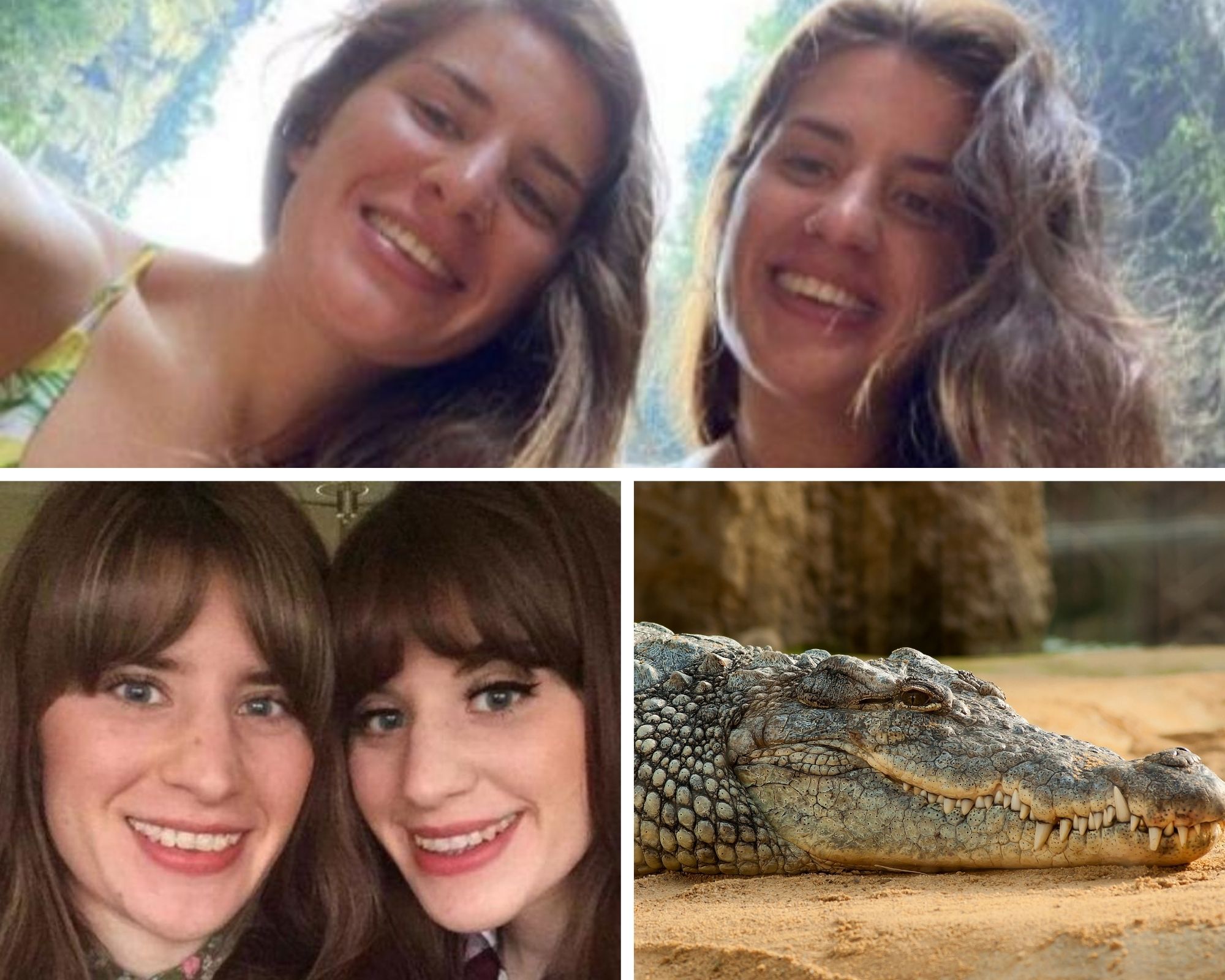 Crocodile Attack Sister S Condition Concerning To Doctors Bracknell News